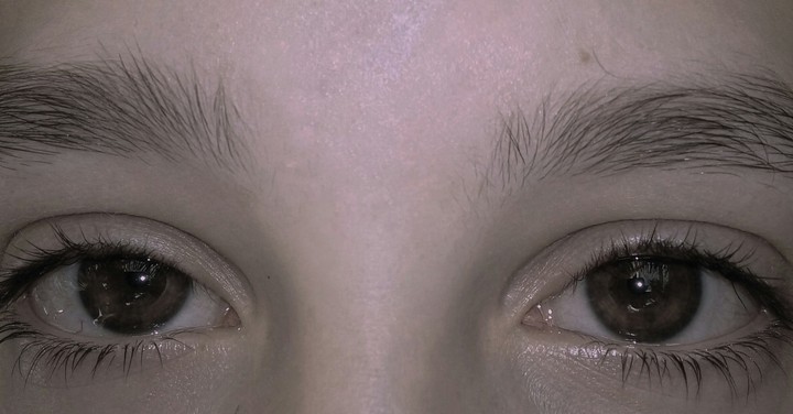 eye
