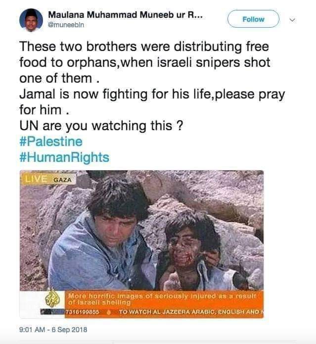 Two Palestinian brothers injured by Israel shelling#humanity