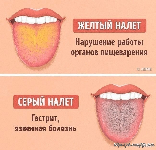 4)