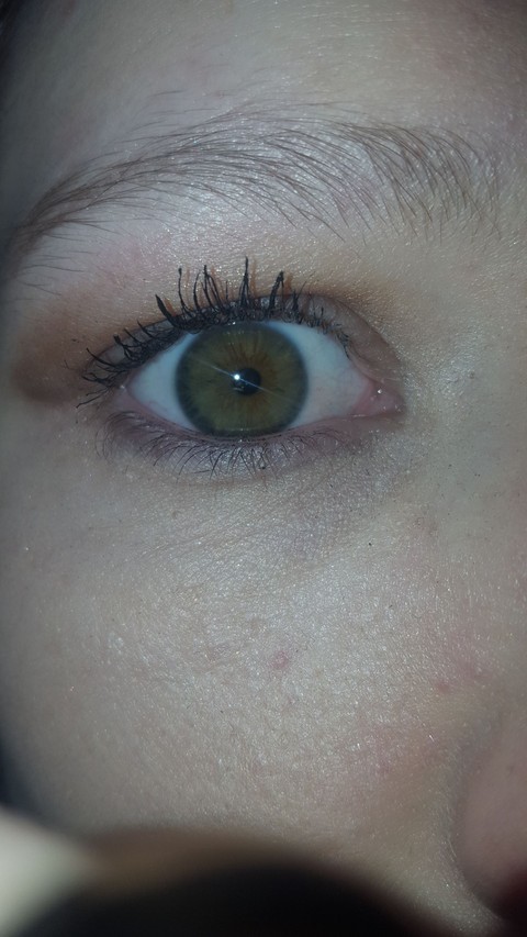 My Eye
