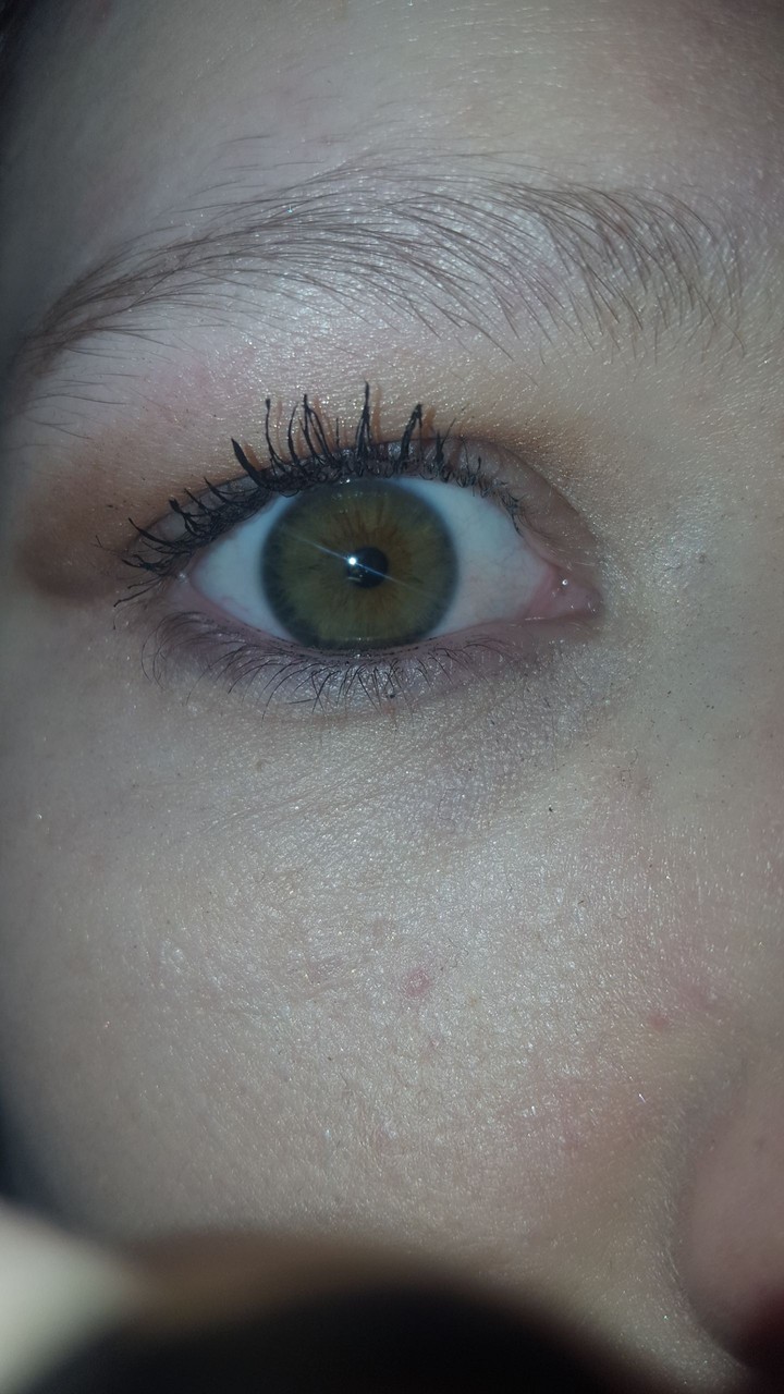 My Eye 