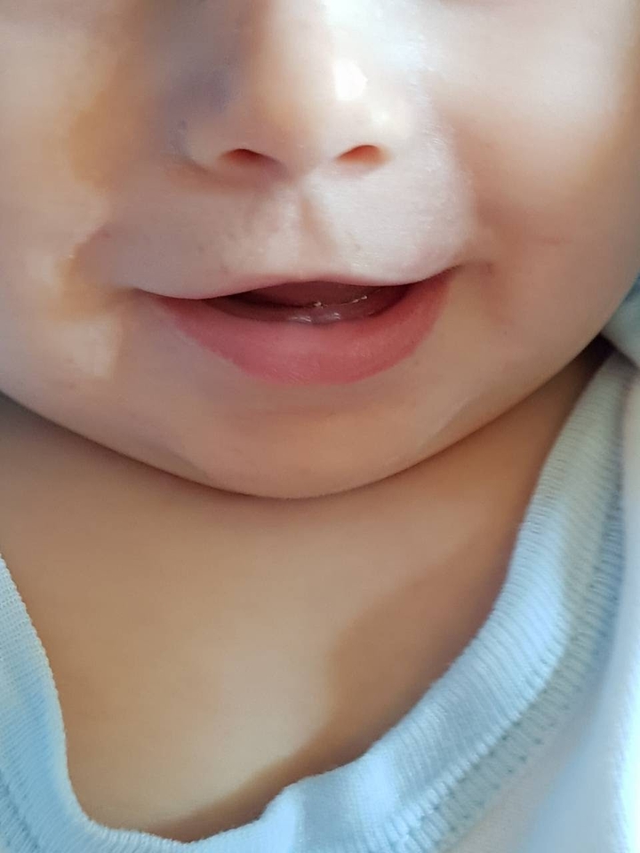 teeth