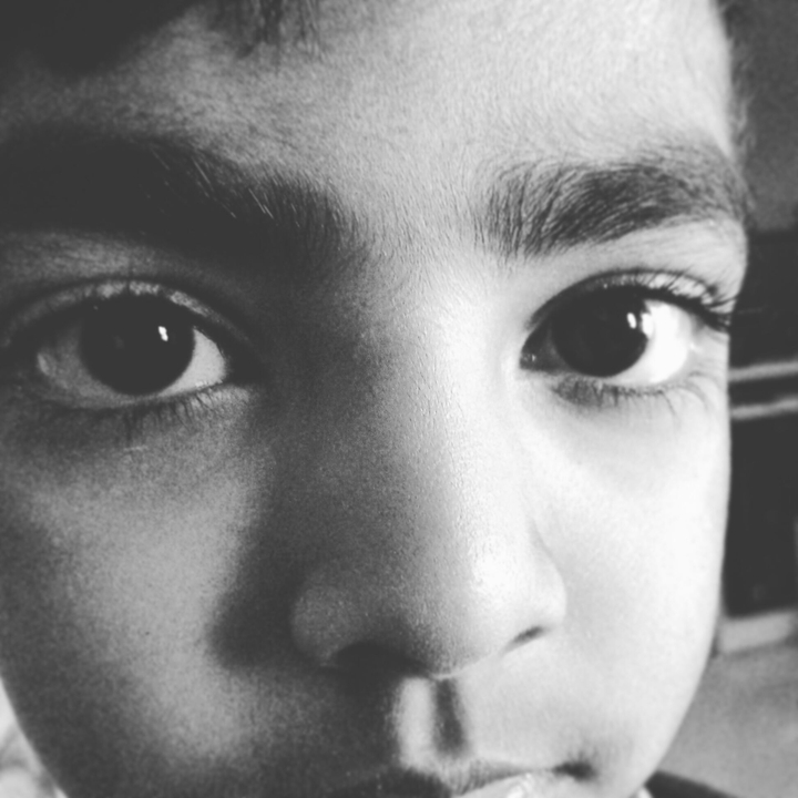 eye