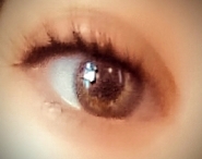 Eye