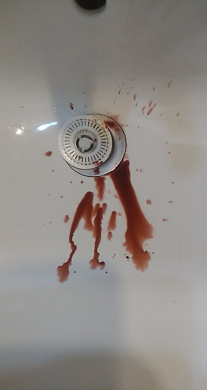 Splash