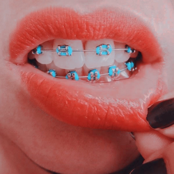 ∆