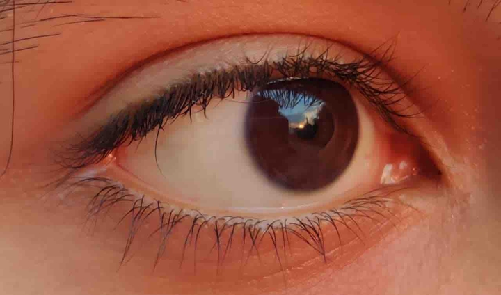 eyes
