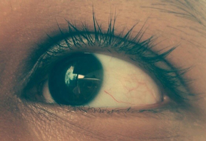 red eyes