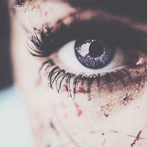 eyes?