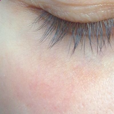 eyelash