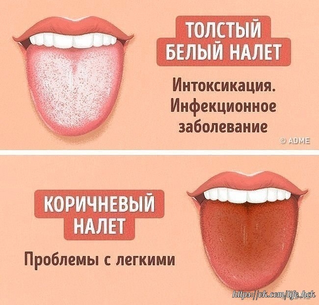 5)