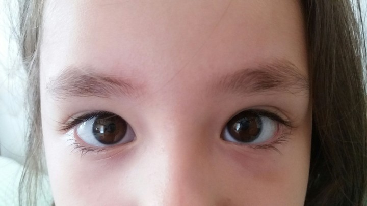 eyes