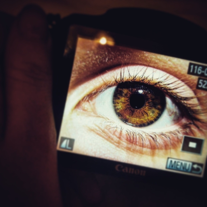 Hazel eye