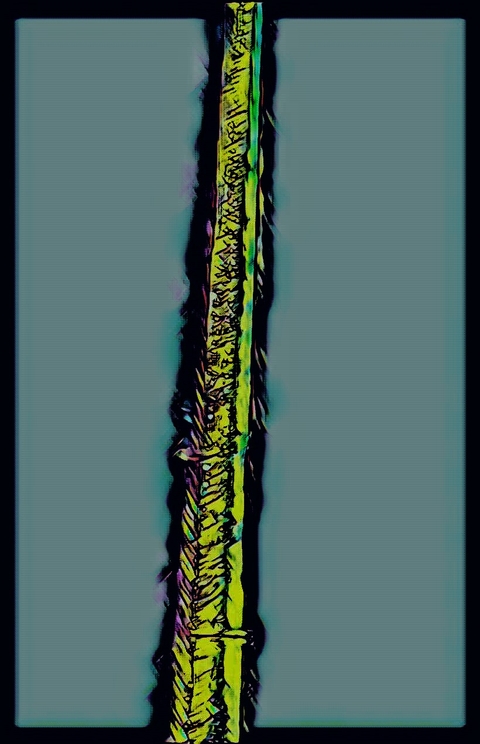 Spinal cord 2