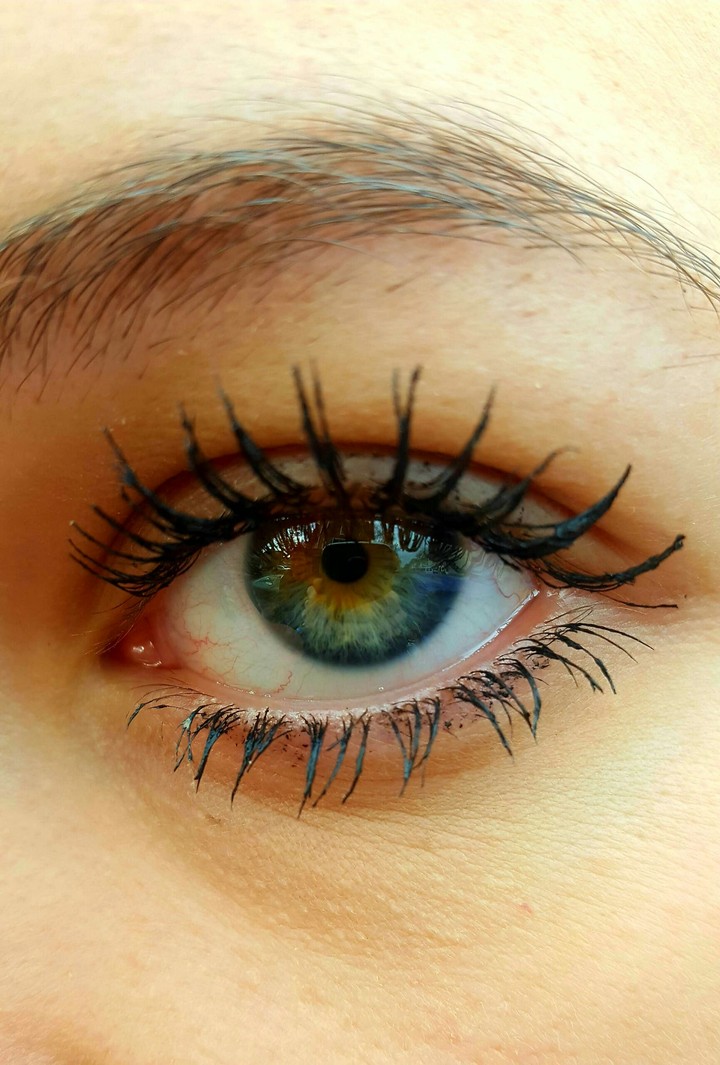 Eye