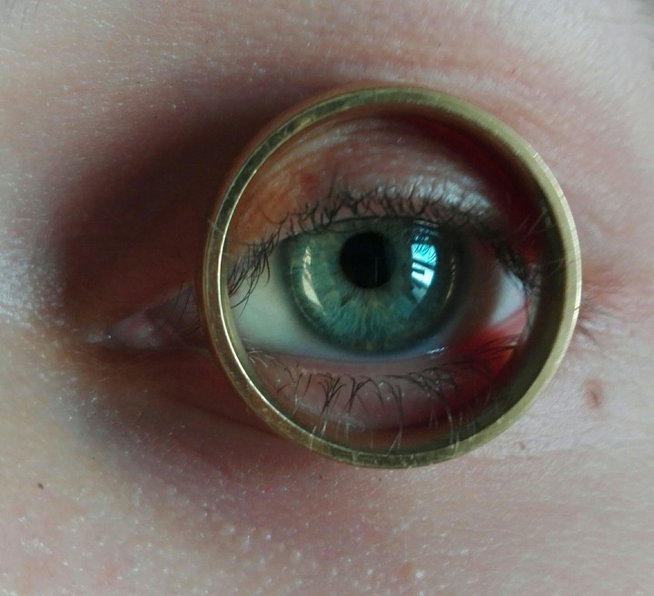Eye