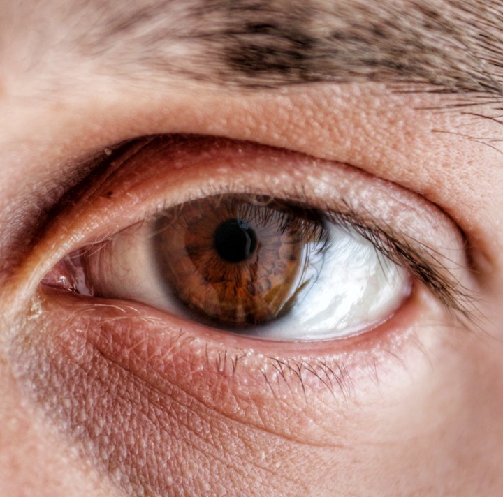 eye