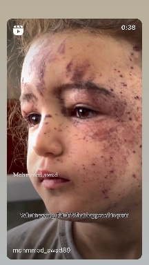 Save Gaza