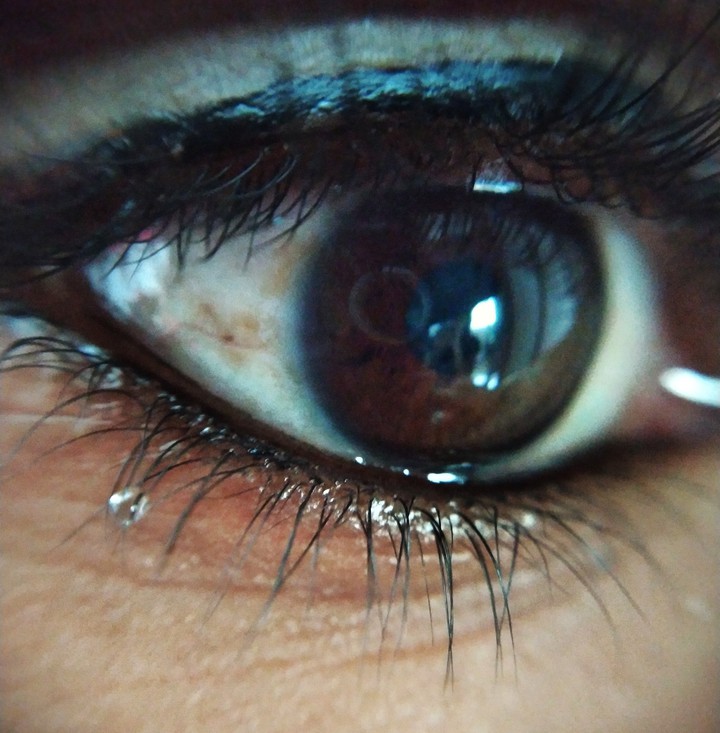 #eye
