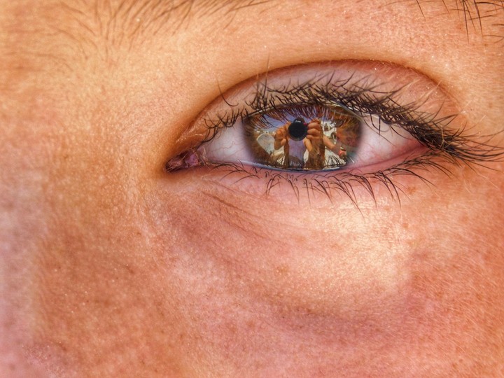EYE