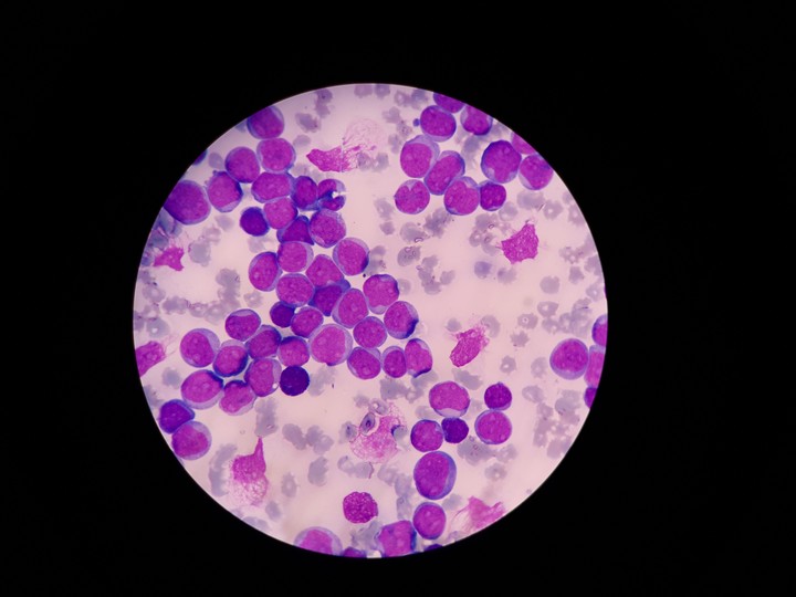 white blood cells