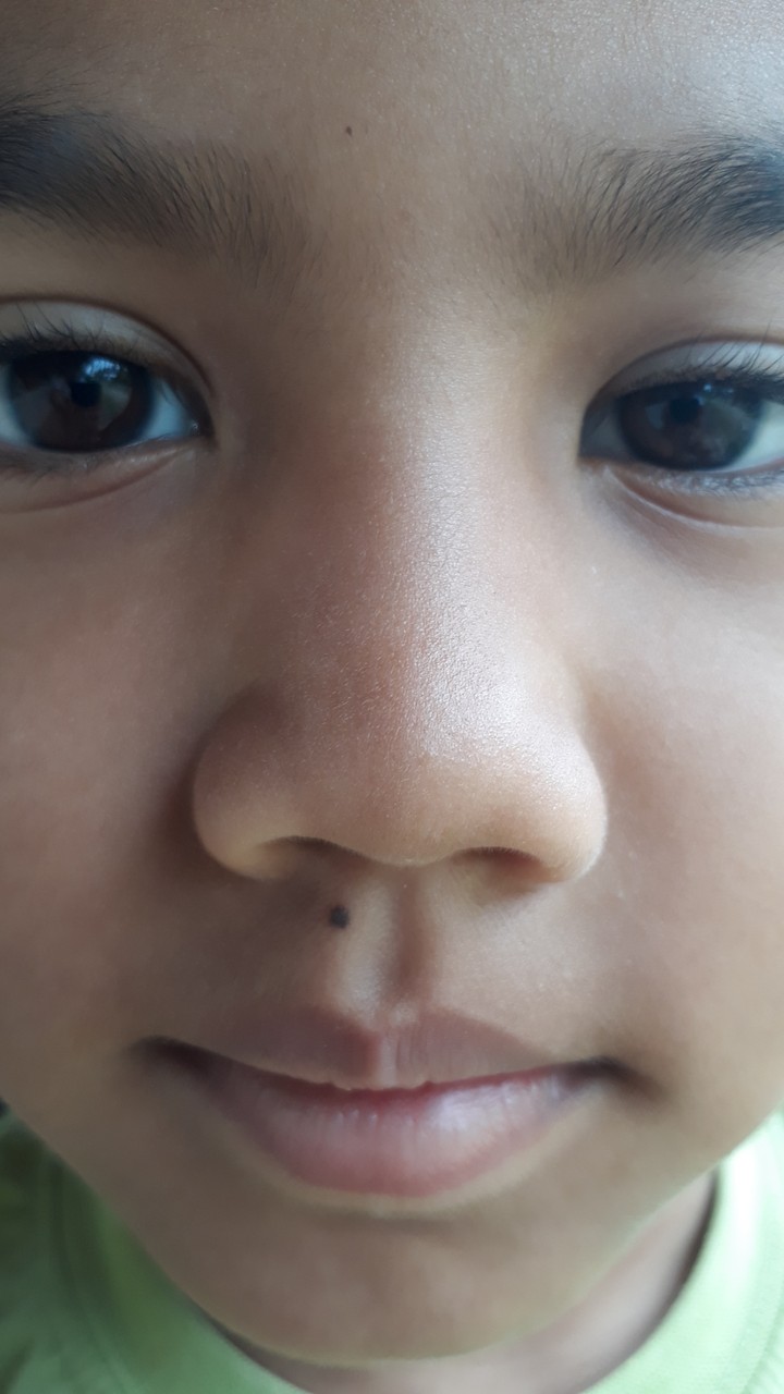 Close Face