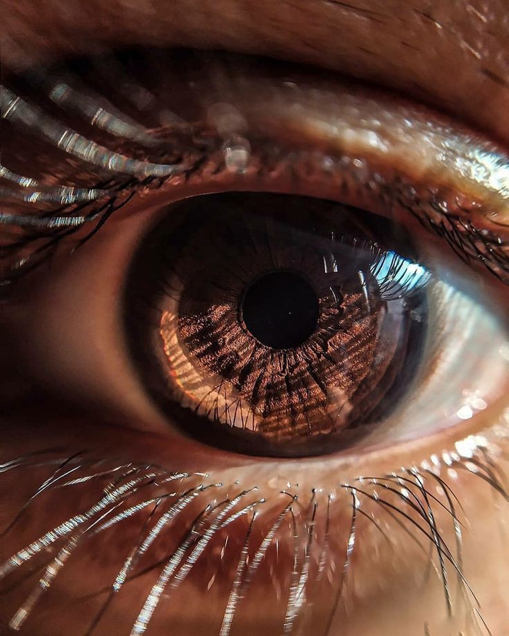 Eye