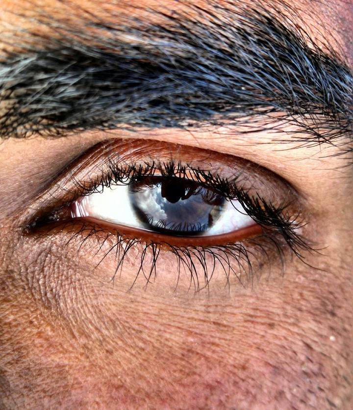 Eye