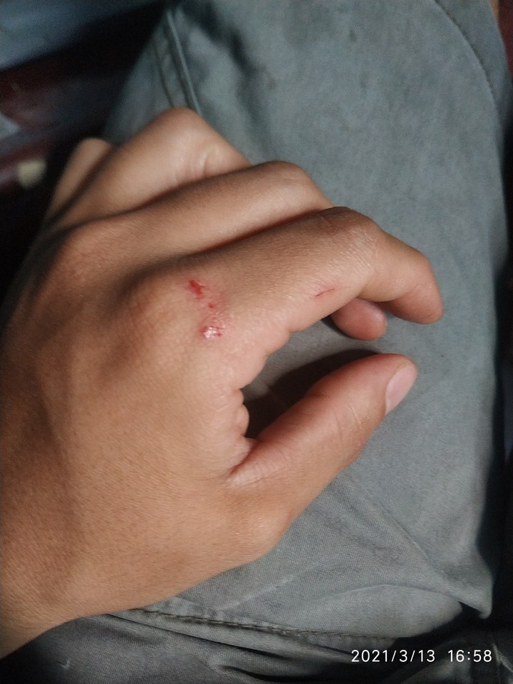 Hand