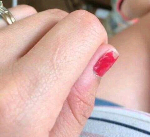 Similar Scars?❤❤❤