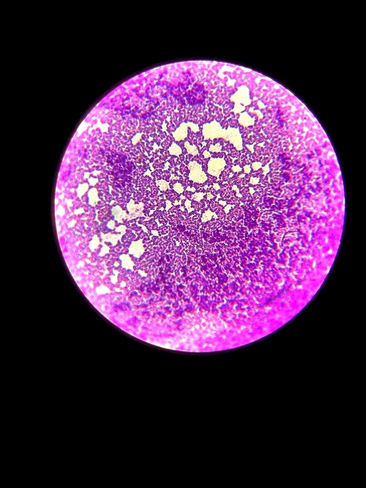 bacterial microscopic sample