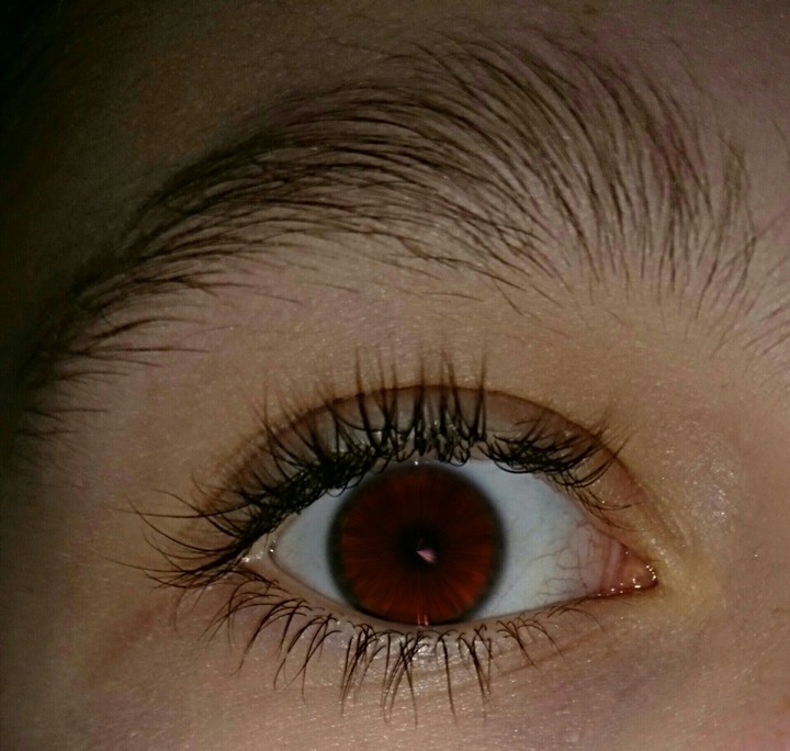 Red eye