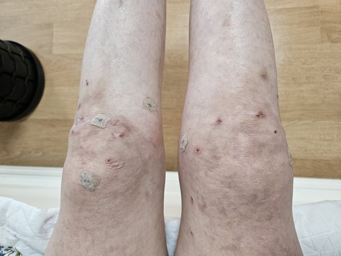 Scar, elbow háttérképek