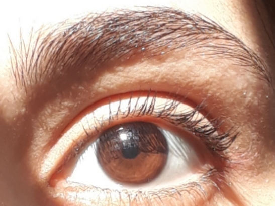 eye
