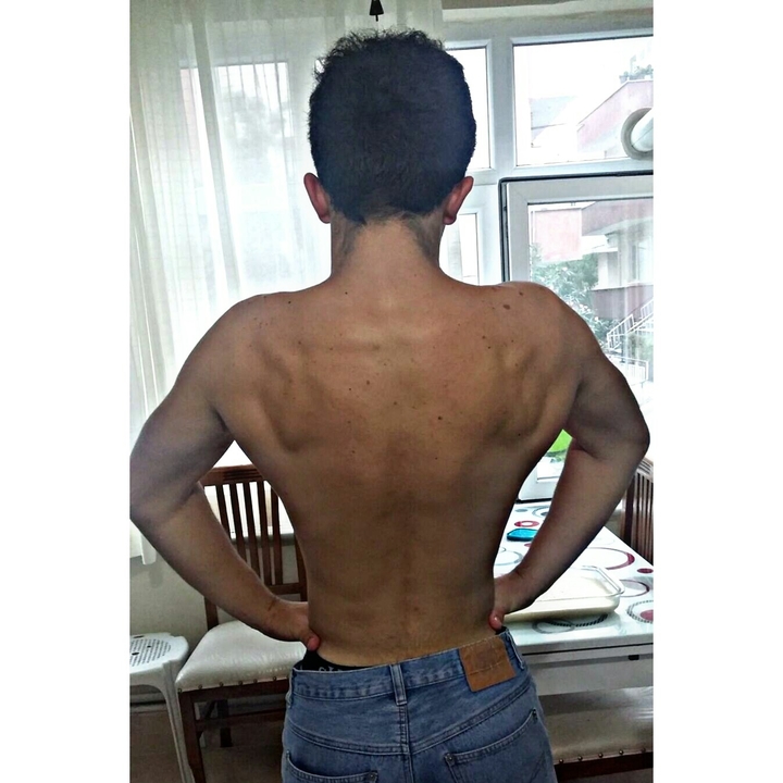 body