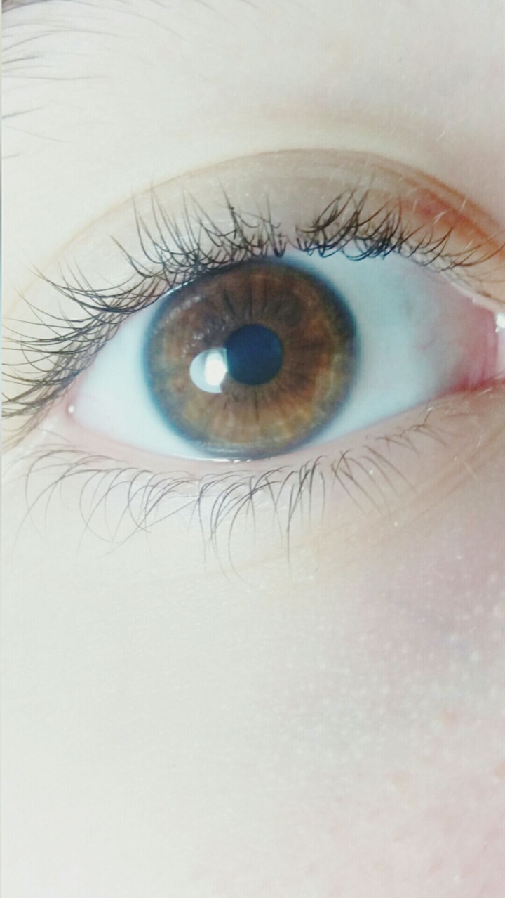 Hazel Eye