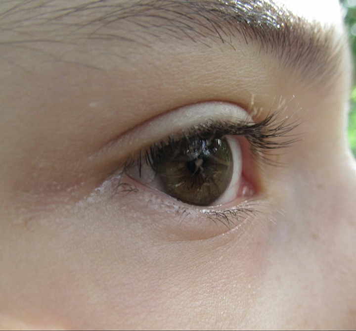 my eye