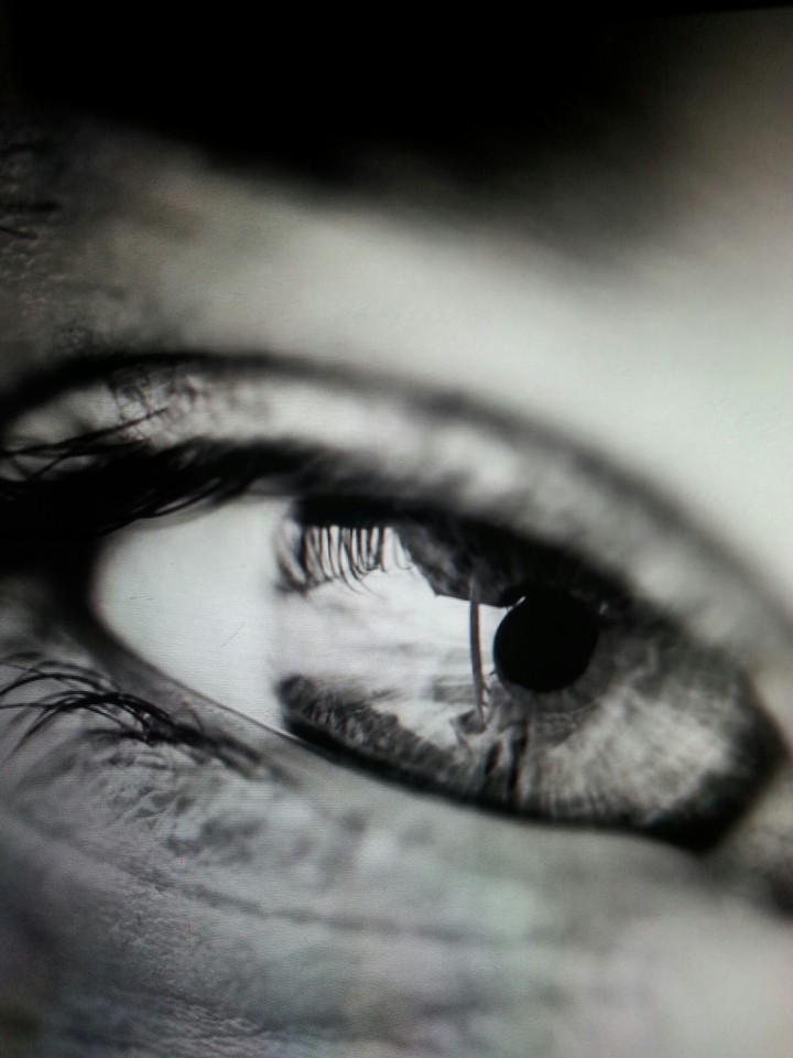 Eye