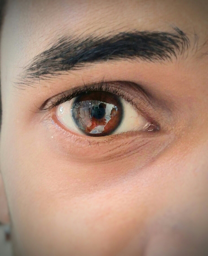 eye