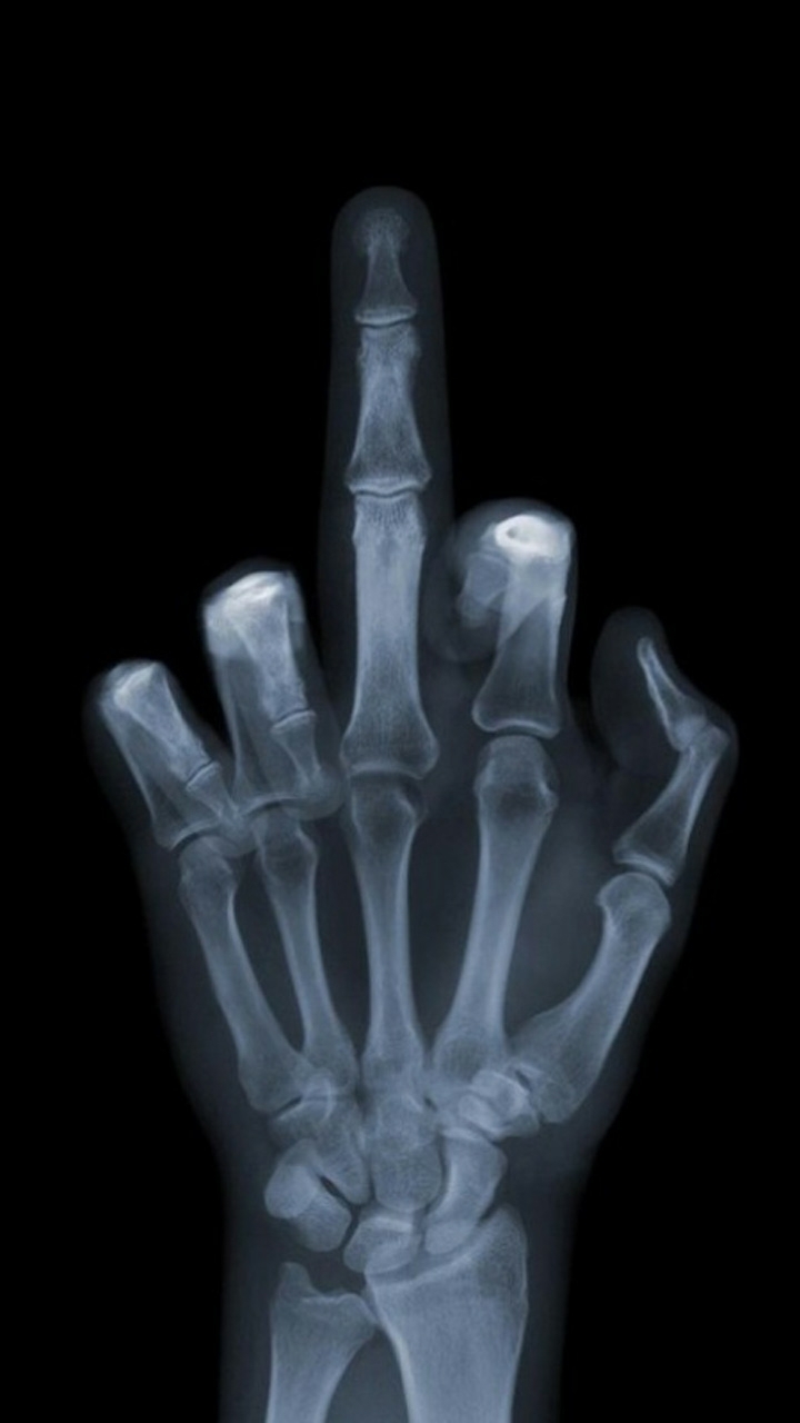 middle finger in the air X-ray