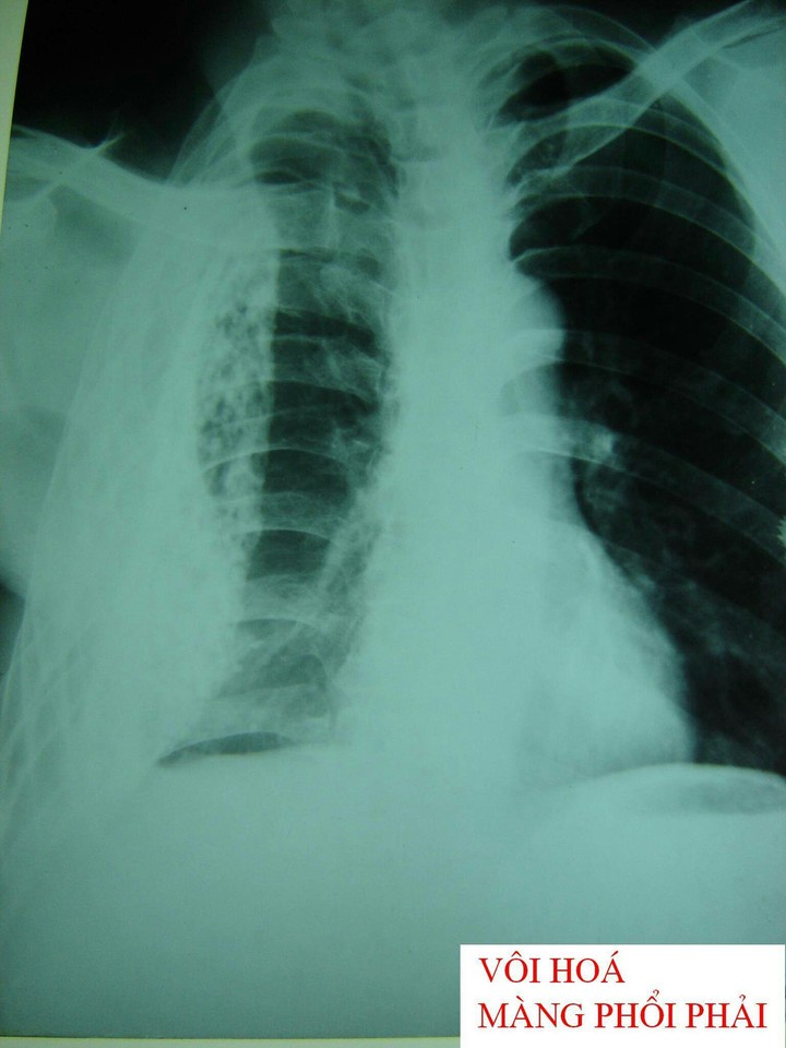 xray