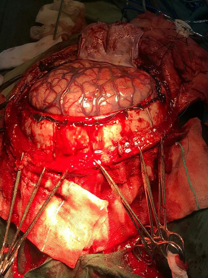 brain