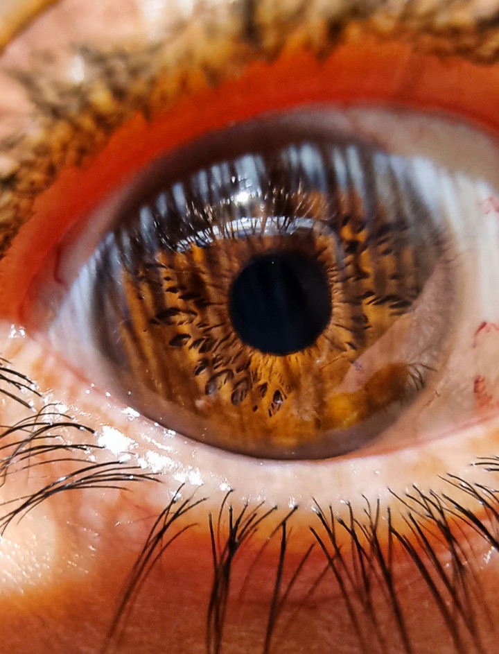 eye