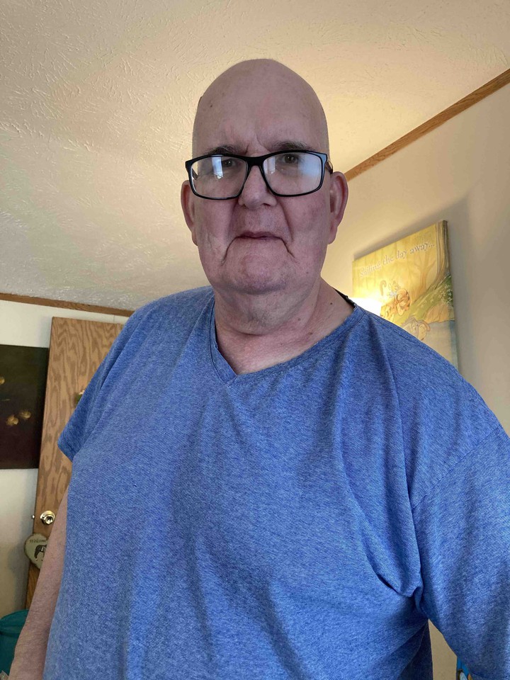 Robert now he has lost a lot of weight