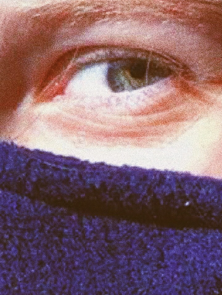eye
