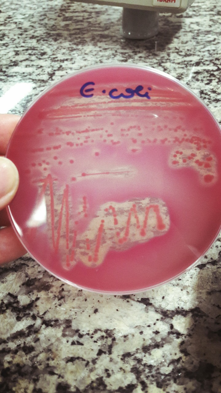 Bactéria Escherichia coli