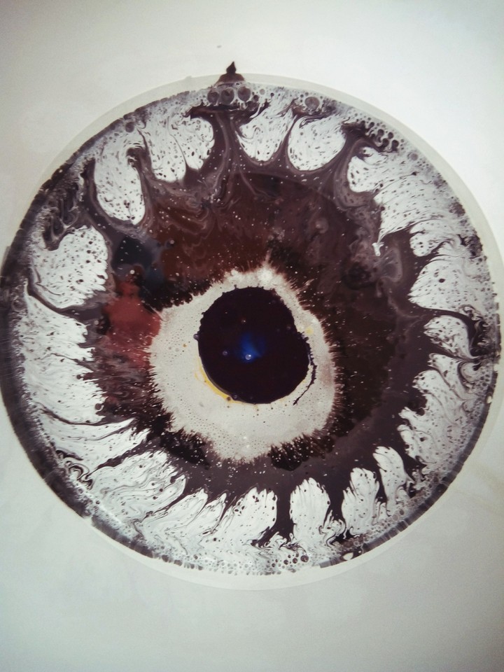 Eye