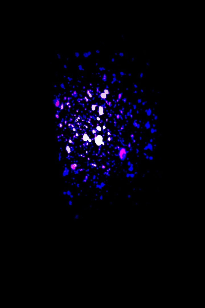 Abstraction