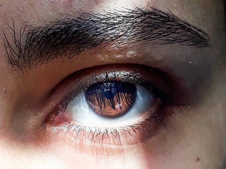 Eye