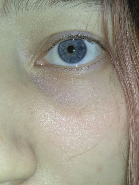 eye